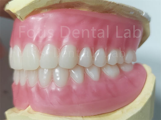 OEM Voll-Ober- und Unter-Acryl-Zahnprothese Fleckenbeständigkeit Natürliche Farbe