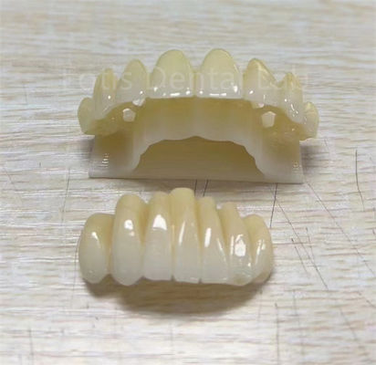 Präzisions-Zirkonium-Mehrschichtprodukt zur Verbesserung der Bruchbeständigkeit