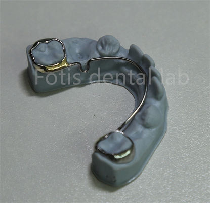 China Zahn-Labor Orthodontik-Halter für Zähne Expansion