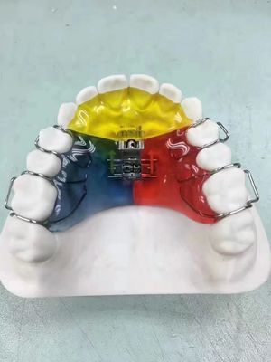 Nance / Hyrax / Rapid Palatal Expander Nachtwächter Raumwächter OEM sicher zu verwenden