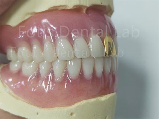 Ästhetik Vollständiges Acryl-Zahnersatz Anpassbares Fit leicht zu reinigen