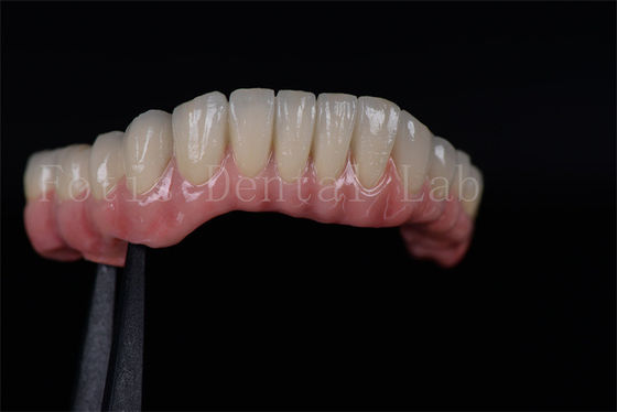 Hohe Erfolgsquote All on Four All on Six Zirkonia Titanium Zahnimplantate maßgeschneidert