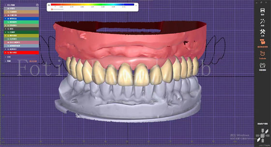 Dienst für die Gestaltung von Zahnprothesen mit Planung von Prothesen und Oralimplantaten