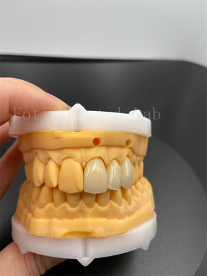 Präzisionspassbare digitale Kronen Implantat Dentrums mit Kompatibilität E-Mail-Übertragung Modus