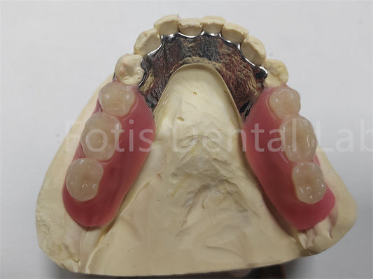 OEM-Flexibel entfernbarer Teilprothese leicht zu reinigen / zu pflegen