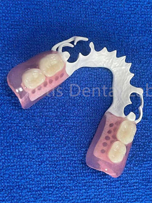 Verstellbarer, flexibler Zahnprothese, stabiler, komfortabler, unmittelbarer, teilweiser Zahnersatz