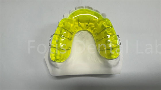 Sicherer Miechigan-Halter-Expander / Orthodontik-Abstandsspalter
