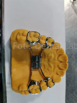 Hygienische Orthodontik-Expanders leicht zu reinigen Zahnhalter verstellbares Design