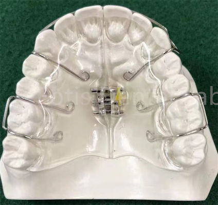 Modernste Orthodontie-Apparat mit Ausdehnungshalter anpassbar