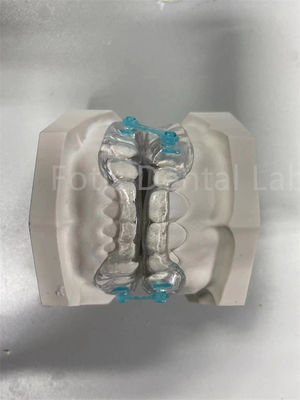 Professionelle Bequem-Fit-Rückhalter-Expander-Orthodontikkorrekturgerät