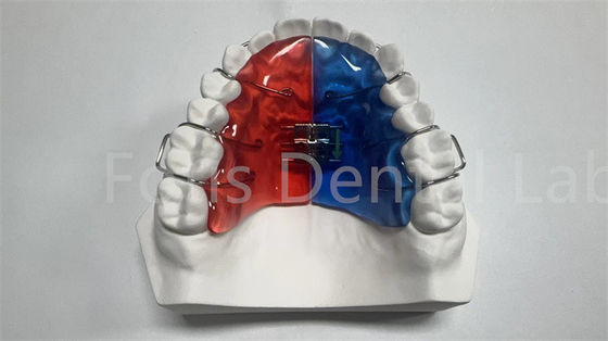 Individuelles Orthodontik-Expander zur Zahnkorrektur und -verbesserung