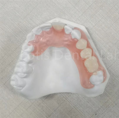 Rosa / Transparente TCS Valplast Geruchsfeste Flexible Zahnprothese