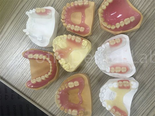 Flexible TCS Valplast Entfernbarer Teilprothese leicht zu verstellen