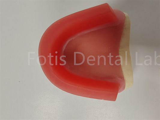 FDA-Zulassung Bissregistrierung Wachs Ringe Zahnprothese Occlusal Rim