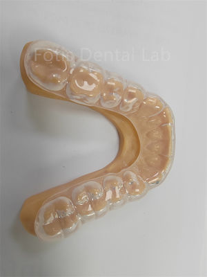 Ergonomische harte weiche Occlusal Guard weiche Zähne Schutz langfristige Verwendung