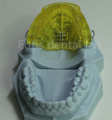 Anpassungsfähiger orthodontischer Halter für das chinesische Zahnlabor