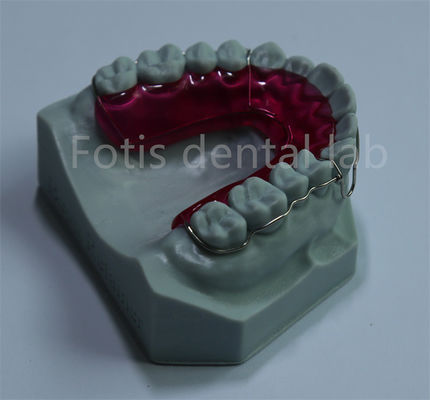 Orthodontische Zahnhalter-Erweiterung Komfortable und erschwingliche Lösung