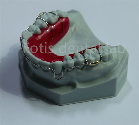 China Dental Lab Retainer Expander für Zahnretention und Expansion