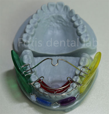 Zahnarztpraxis Ortho-Palatal-Expander Vielseitig und wirksam für die Zahnausrichtung