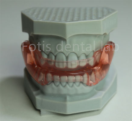 OEM-Orthodontik-Halter-Erweiterung für alle Größen Kompatibel mit den meisten orthodontischen Behandlungen