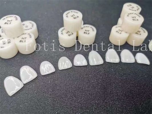 Anpassung Zahnlabor Laminat Veneers mit hoher Fleckenbeständigkeit und Festigkeit