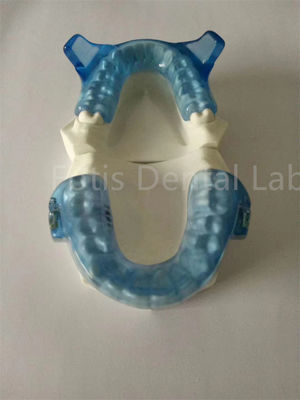 Fortgeschrittene Orthodontie-Geräte für eine bessere Zahnausrichtung