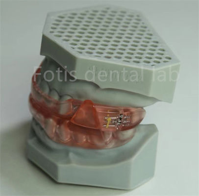 Erschwinglicher Zahnlabor Hyrax-Expander Orthodontik-Halter leicht zu reinigen und zu pflegen